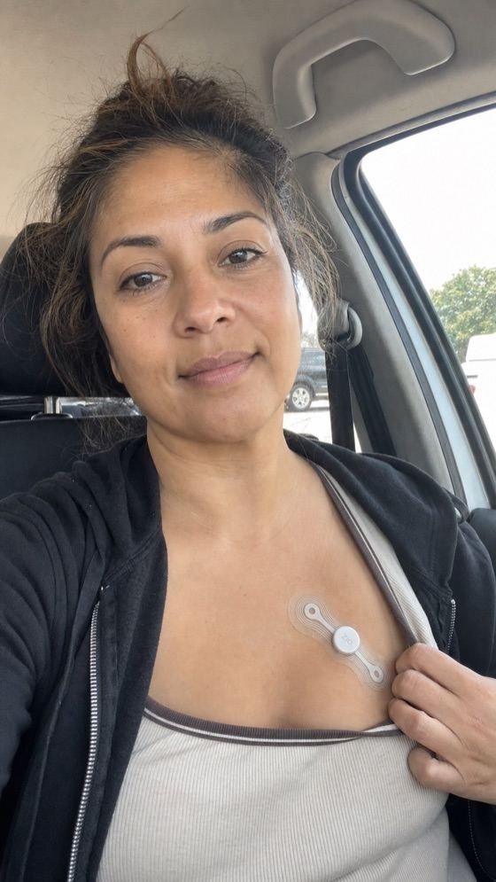 Patient showing a Zio heart monitor patch